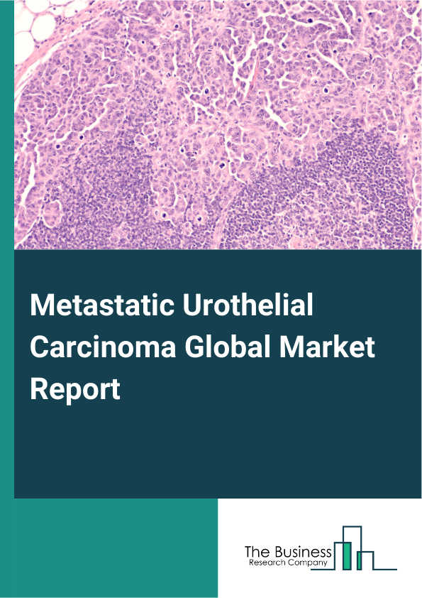 Global Metastatic Urothelial Carcinoma Market Report 2025