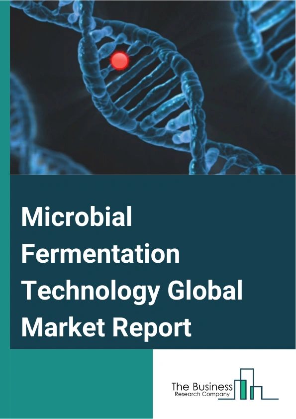 Global Microbial Fermentation Technology Market Report 2025