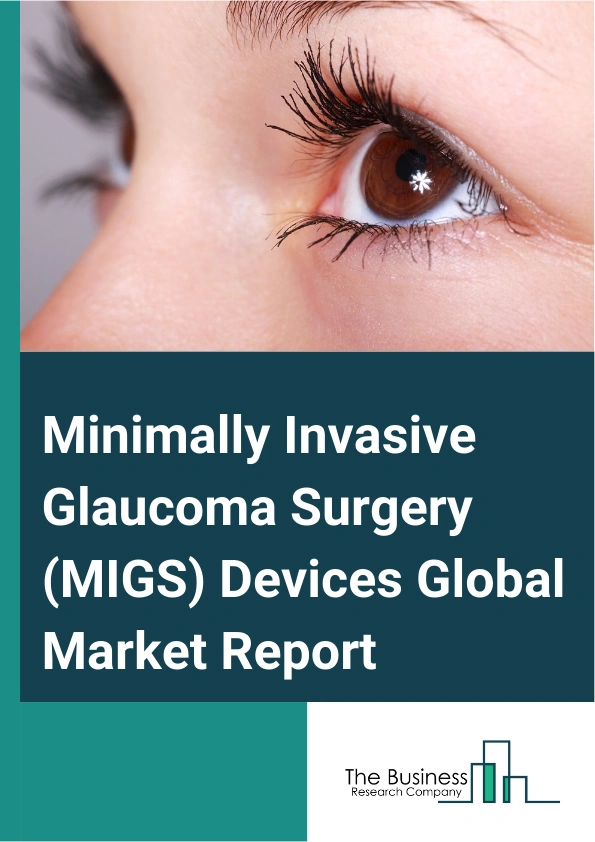 Global Minimally Invasive Glaucoma Surgery (MIGS) Devices Market Report 2025