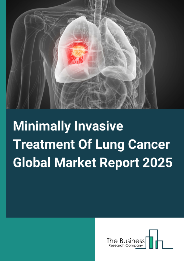 Global Minimally Invasive Treatment Of Lung Cancer Market Report 2025 