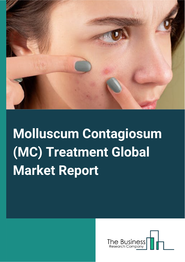 Global Molluscum Contagiosum (MC) Treatment Market Report 2025