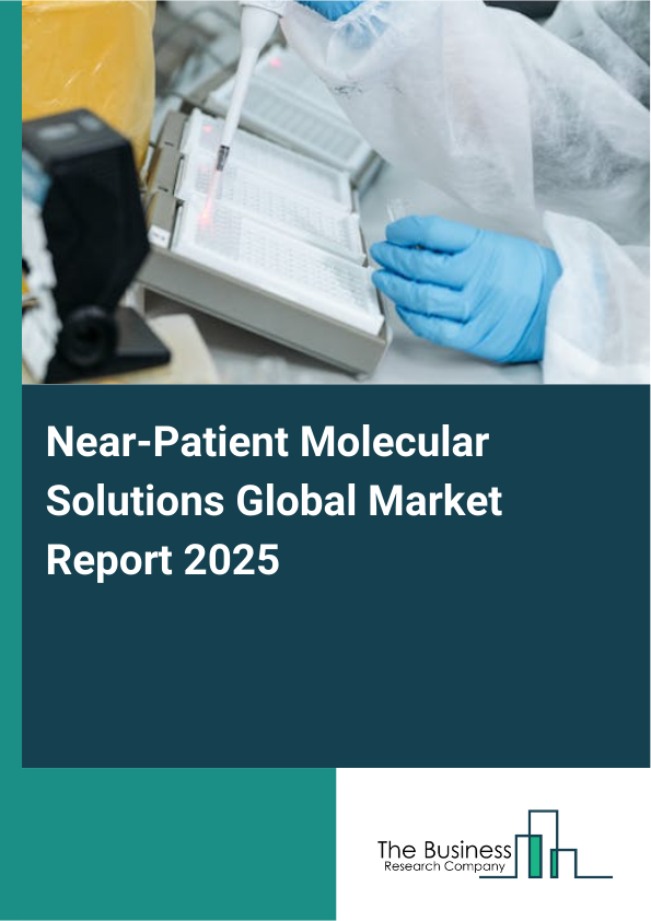 Global Near_Patient Molecular Solutions Market Report 2025