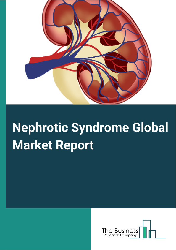 Global Nephrotic Syndrome Market Report 2025