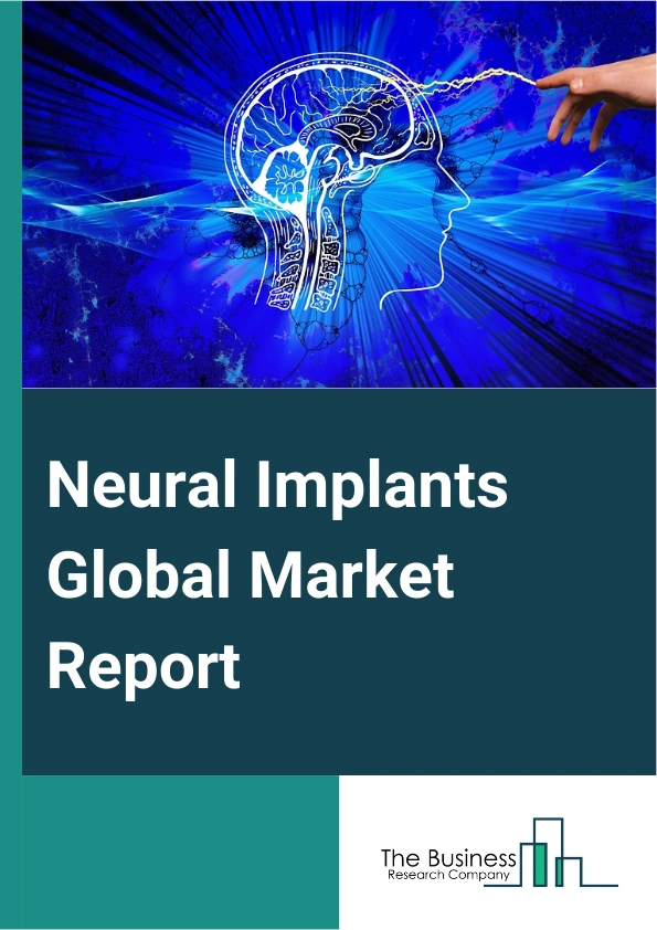 Global Neural Implants Market Report 2025