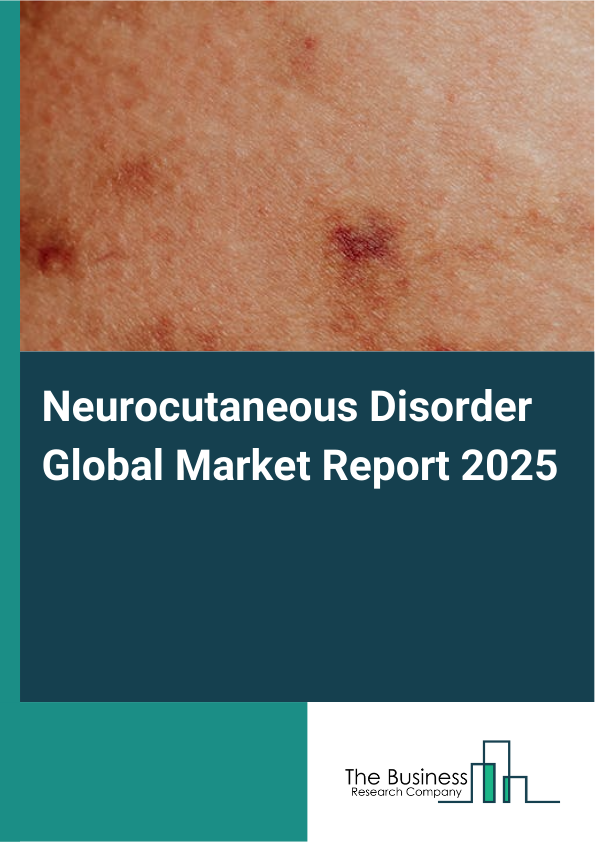 Global Neurocutaneous Disorder Market Report 2025