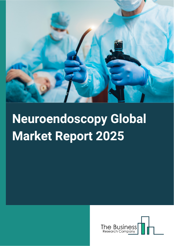 Global Neuroendoscopy Market Report 2025 