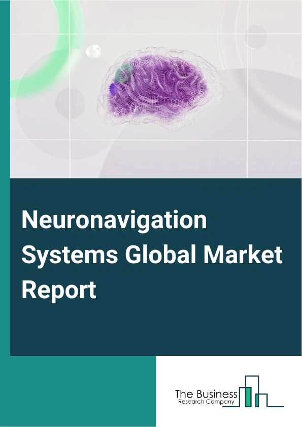 Global Neuronavigation Systems Market Report 2025