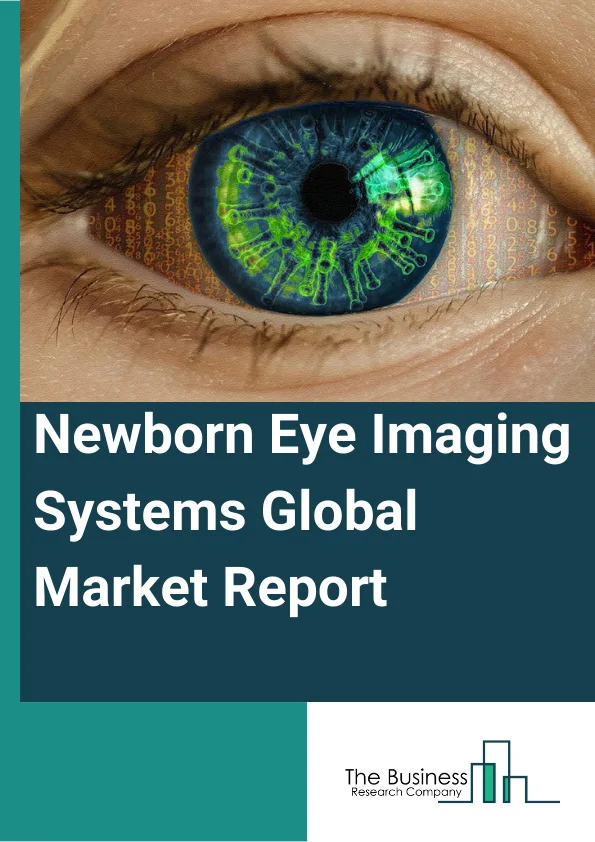 Newborn Eye Imaging Systems Global Market Report 2024 – By Disease Type (Retinopathy Of Prematurity (ROP), Retinal Disease, Strabismus, Refractive Error, Color Blindness, Other Disease Types), By Device Type (Basic Device, Wireless Device ), By End User (Hospitals, Ophthalmology Diagnosis Centers, Ambulatory Surgical Centers, Other End Users ) – Market Size, Trends, And Global Forecast 2024-2033