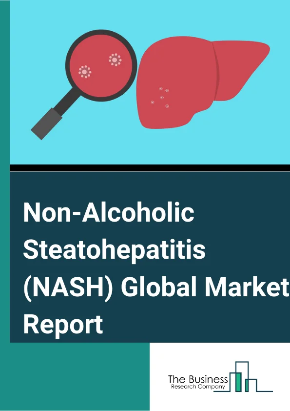 Global Non Alcoholic Steatohepatitis NASH Market Report 2024