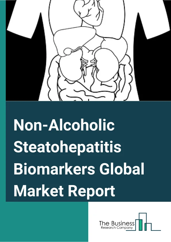 Non-Alcoholic Steatohepatitis Biomarkers Global Market Report 2023 – By Type (Hepatic Fibrosis Biomarkers, Serum Biomarkers, Oxidative Stress Biomarkers, Apoptosis Biomarkers, Other Types), By Disease (Hypertension, Heart Disease, High Blood Lipid, Type 2 Diabetes, Obesity), By End Use(Research Institutes And Academics, Diagnostic Centres, Pharmaceutical Companies And Pharmaceutical Companies And Contract Research Organizations (CROs), Hospitals And Clinics, Other End-Uses) – Market Size, Trends, And Market Forecast 2023-2032