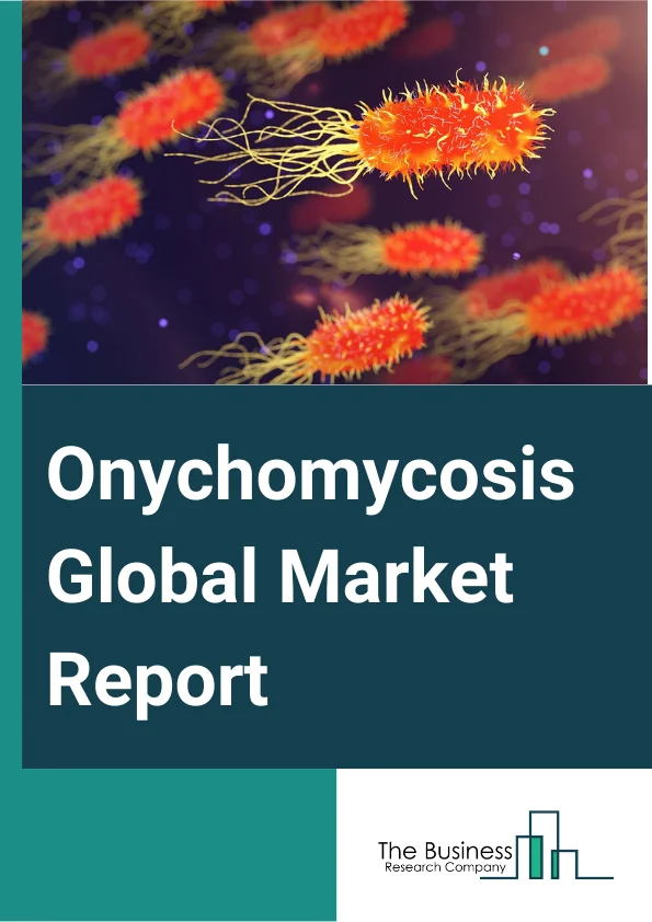 Onychomycosis