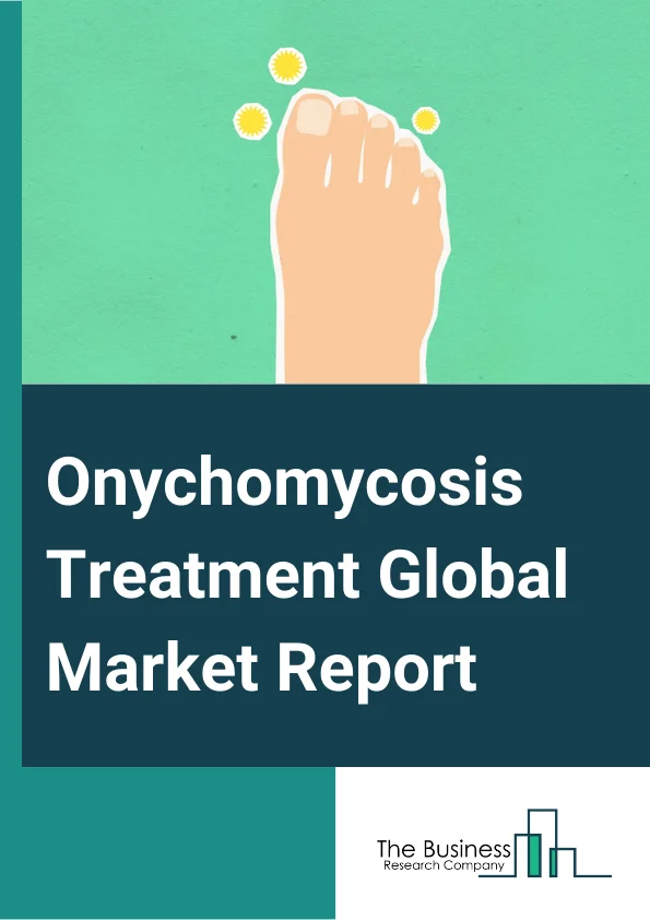 Onychomycosis Treatment Global Market Report 2024 