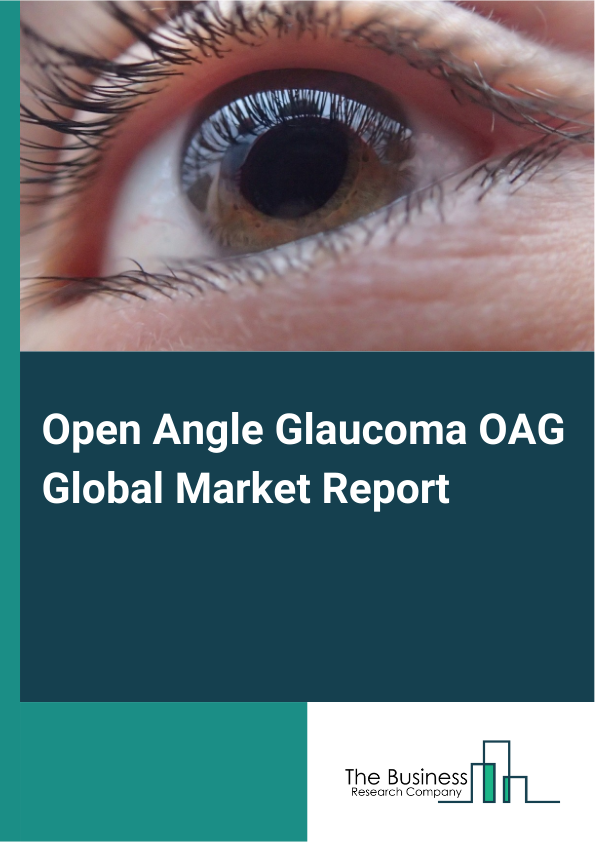 Global Open Angle Glaucoma OAG Market Report 2025