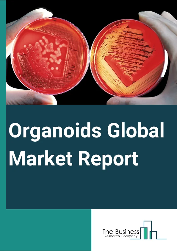 Organoids Global Market Report 2025 – By Product (Hepatic Organoid, Colorectal Organoid, Intestinal Organoid, Other Organoid), By Source (Pluripotent Stem Cells, Organ-Specific Adult Stem Cells), By Application (Developmental Biology, Disease Pathology Of Infectious Disease, Regenerative Medicine, Drug Toxicity And Efficacy Testing, Drug Discovery And Personalized Medicine, Other Applications), By End-User (Hospitals And Diagnostic Centers, Biotechnology And Pharmaceutical Companies, Other End-Users) – Market Size, Trends, And Global Forecast 2025-2034