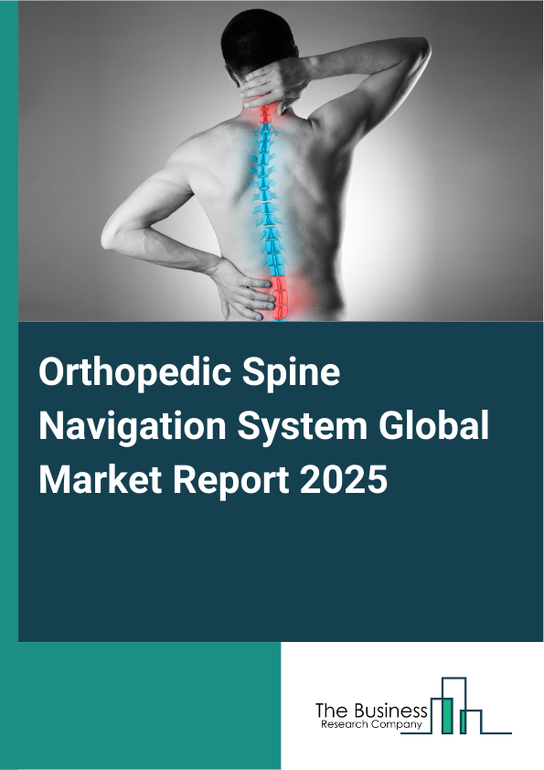 Global Orthopedic Spine Navigation System Market Report 2025