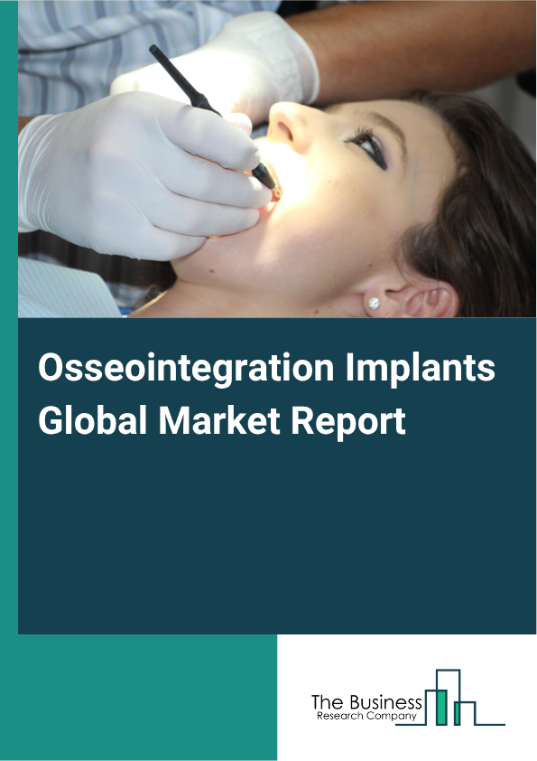 Global Osseointegration Implants Market Report 2025