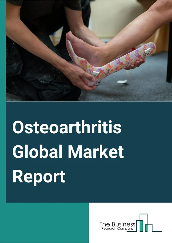 Osteoarthritis Global Market Report 2024 