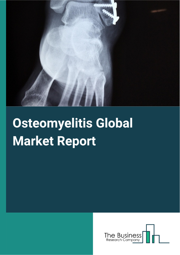 Global Osteomyelitis Market Report 2025