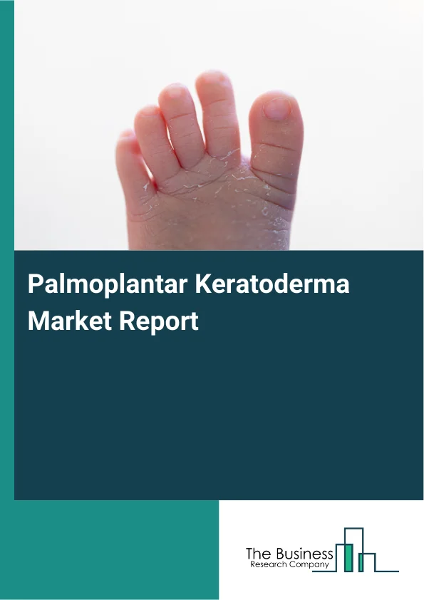 Palmoplantar Keratoderma Market Report Infographic Image