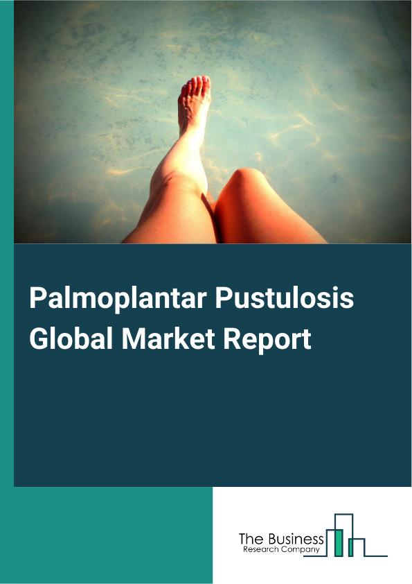 Global Palmoplantar Pustulosis Market Report 2025