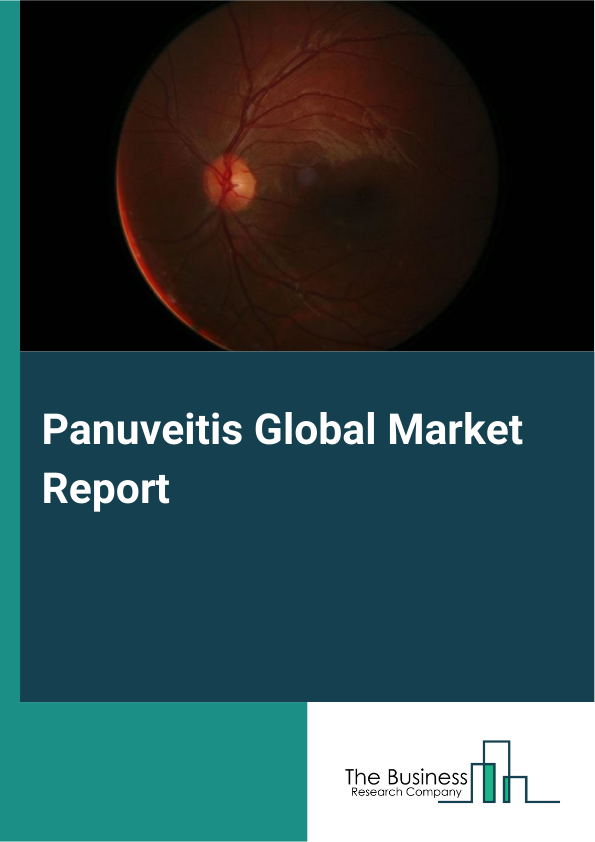 Global Panuveitis Market Report 2025