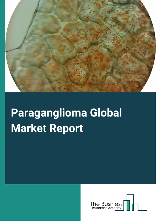 Global Paraganglioma Market Report 2025