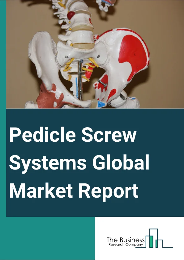 Global Pedicle Screw Systems Market Report 2024