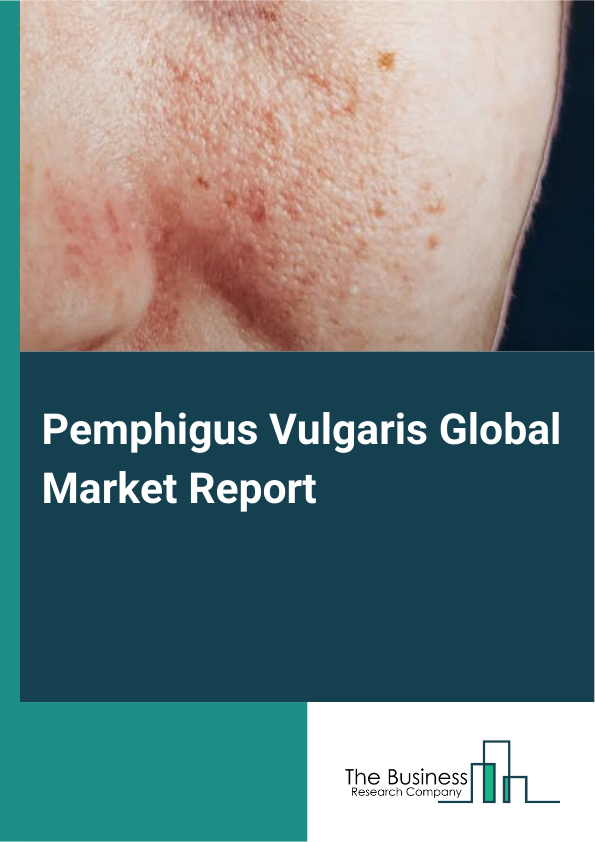 Global Pemphigus Vulgaris Market Report 2025