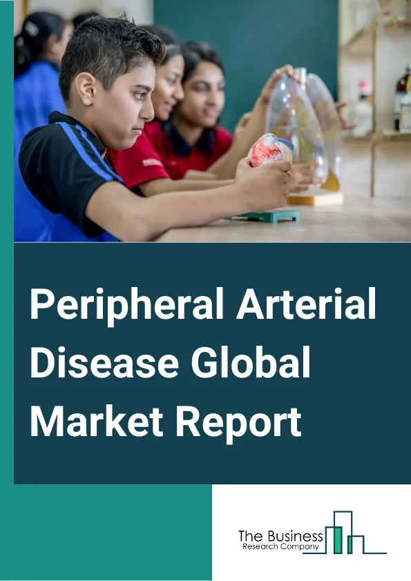 Peripheral Arterial Disease Global Market Report 2024 