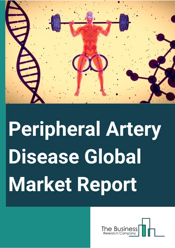 Peripheral Artery Disease Global Market Report 2023