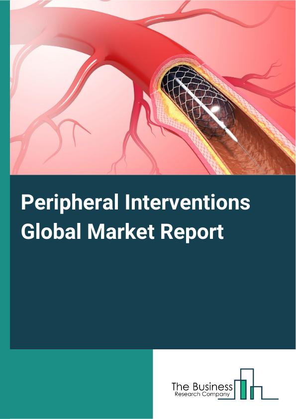 Global Peripheral Interventions Market Report 2025