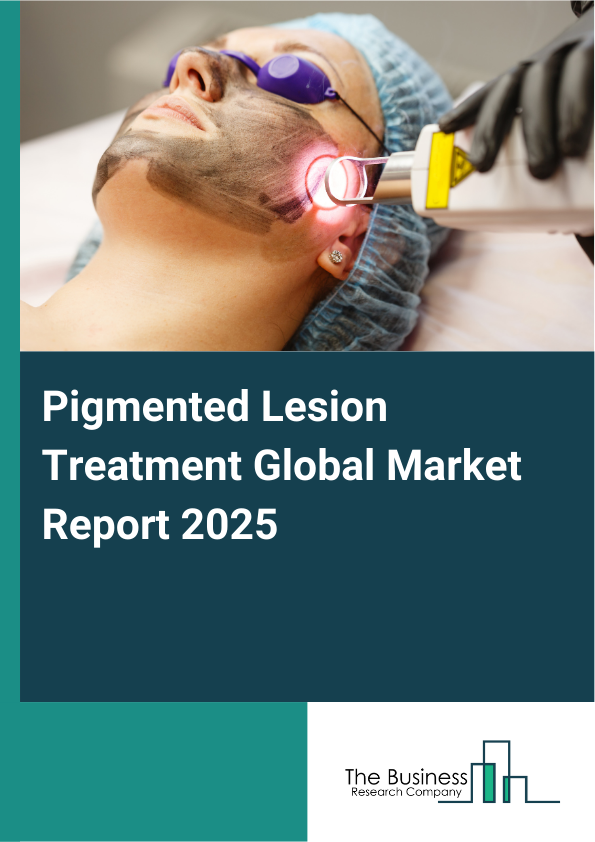 Global Pigmented Lesion Treatment Market Report 2025