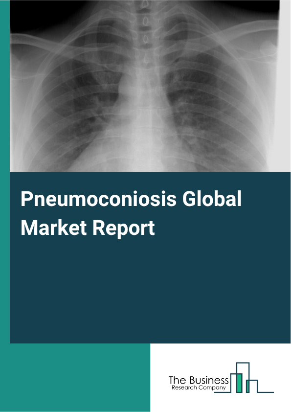 Global Pneumoconiosis Market Report 2025