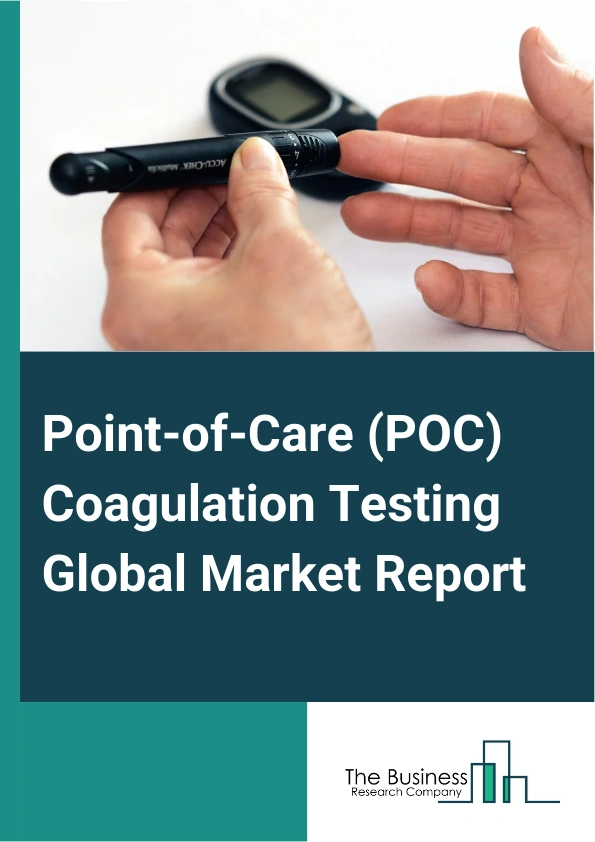 Point-of-Care (POC) Coagulation Testing Global Market Report 2025 – By Technology (Optical Technology, Mechanical Technology, Electrochemical Technology), By Distribution Channel (Direct Tenders, Retail), By End-User (Hospitals, Clinics, Home care) – Market Size, Trends, And Global Forecast 2025-2034