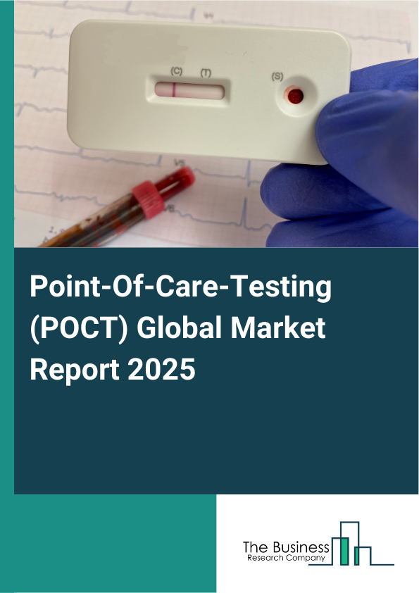 Global Point-Of-Care-Testing (POCT) Market Report 2025