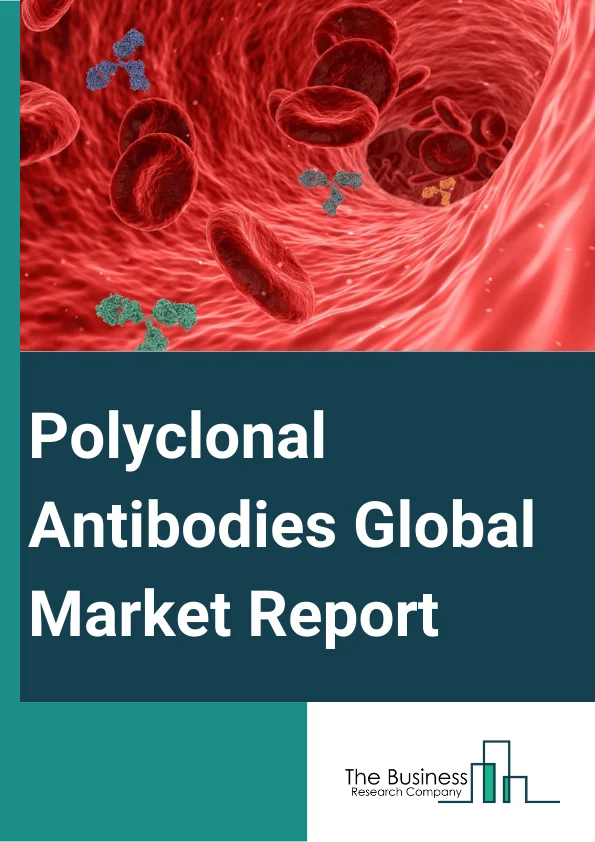 Polyclonal Antibodies Global Market Report 2025 – By Product Type (Primary Antibody, Secondary Antibody), By Source (Rabbits, Goats, Sheep, Other Sources), By Application (Research, Diagnostics, Therapy), By End-User (Academic and Research Center , Pharmaceutical and Biotechnology Companies, Diagnostic Centers , Hospitals) – Market Size, Trends, And Global Forecast 2025-2034