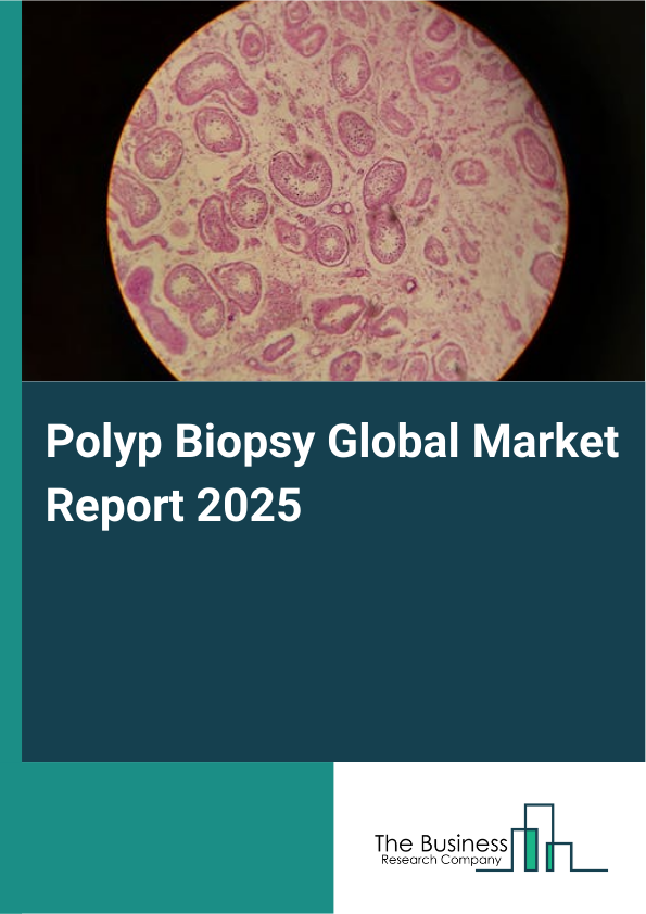 Global Polyp Biopsy Market Report 2025
