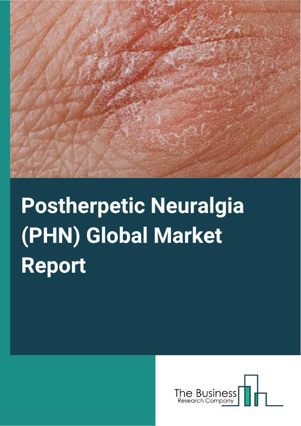 Postherpetic Neuralgia (PHN) Market Global Report 2026 Market Report Infographic Image