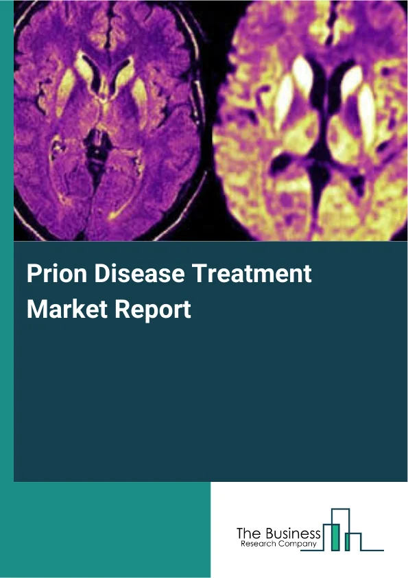 Prion Disease Treatment Market Report Infographic Image