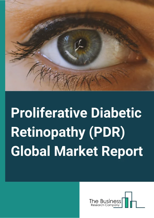 Proliferative Diabetic Retinopathy (PDR) Global Market Report 2025 – By Treatment Type (Anti-VEGF (Vascular Endothelial Growth Factor) Therapy, Intraocular Steroids, Laser Surgery, Vitrectomy), By Mode of Administration (Injectables, Oral, Other Mode Of Administrations), By Application (Hospitals, Clinics, Other Applications) – Market Size, Trends, And Global Forecast 2025-2034