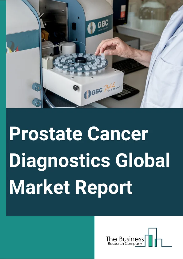 Prostate Cancer Diagnostics Global Market Report 2024 – By Products (Instruments, Reagents And Consumables, Accessories), By Test Type (Preliminary Tests, Confirmatory Tests), By Prostate Cancer (Squamous Cell Cancer, Small Cell Carcinoma, Transitional Cell Cancer, Prostatic Adenocarcinoma, Ductal Adenocarcinoma, Small Cell Prostate Cancer, Acinar Adenocarcinoma), By Peer Groups (Adult, Pediatric, Geriatrics), By End User (Hospitals, Independent Diagnostic Laboratories, Cancer Research Institutes, Other End-Users) – Market Size, Trends, And Global Forecast 2024-2033