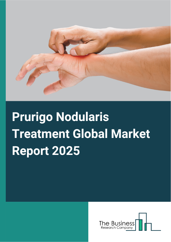 Global Prurigo Nodularis Treatment Market Report 2025