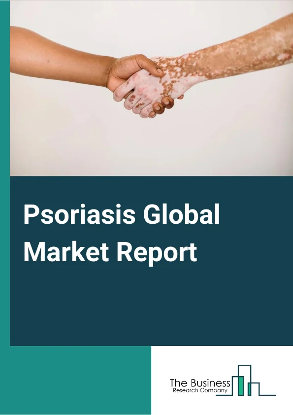 Psoriasis Global Market Report 2024 – By Drug class (Interleukin Inhibitors, Corticosteroids, Anti-Inflammatory, Tumor Necrosis Factor Inhibitor ), By Drug Types (Small molecules, Biologics  ), By Disease Indication (Plaque Psoriasis, Nail Psoriasis, Guttate Psoriasis, Pustular Psoriasis, Erythrodermic Psoriasis), By Route Of Administration (Oral, Tropical, Injectable ), By Distribution Channel (Hospitals, Retail Pharmacies, E-Commerce ) – Market Size, Trends, And Global Forecast 2024-2033