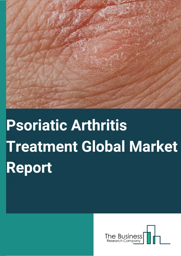 Psoriatic Arthritis Treatment Global Market Report 2023 – By Drug Class (Nonsteroidal Anti-Inflammatory Drugs (NSAIDS), Disease-Modifying Anti-Rheumatic Drugs (DMARDS), Biologics, Other Drug Classes), By Route Of Administration (Oral, Parenteral, Topical), By Distribution Channel (Hospital Pharmacies, Retail Pharmacies, Online Pharmacies) – Market Size, Trends, And Global Forecast 2023-2032