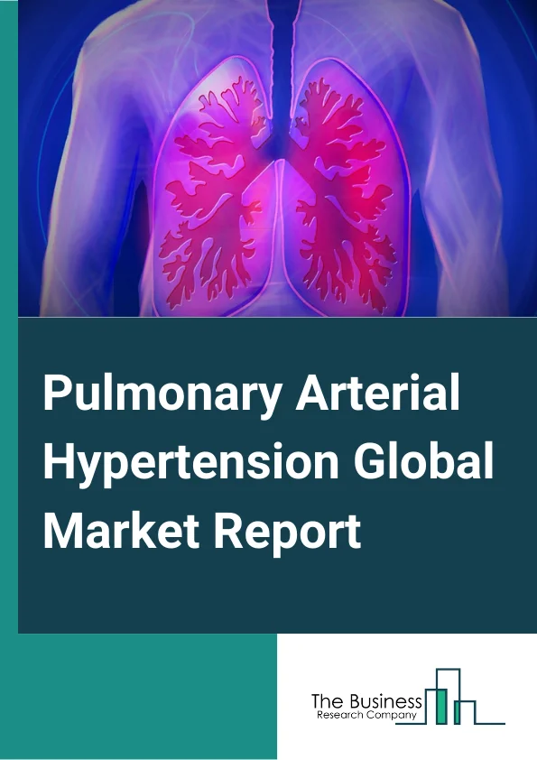 Pulmonary Arterial Hypertension Global Market Report 2023 – By Drug Class (Endothelin Receptor Antagonists (ERAs), PDE 5 Inhibitors, Prostacyclin and Prostacyclin Analogs, SGC Stimulators), By Route of Administration (Oral, Intravenous/ subcutaneous, Inhalational), By Distribution channel (Retail, Online) – Market Size, Trends, And Global Forecast 2023-2032