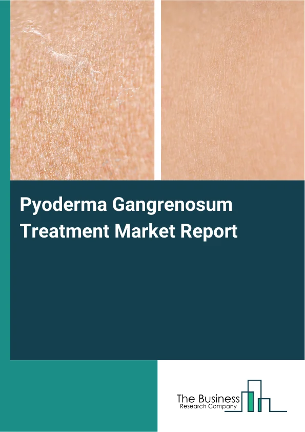 Pyoderma Gangrenosum Treatment Market Report Infographic Image
