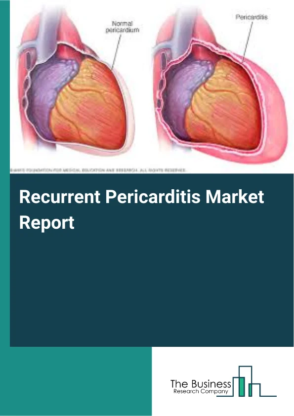 Recurrent Pericarditis Market Report Infographic Image