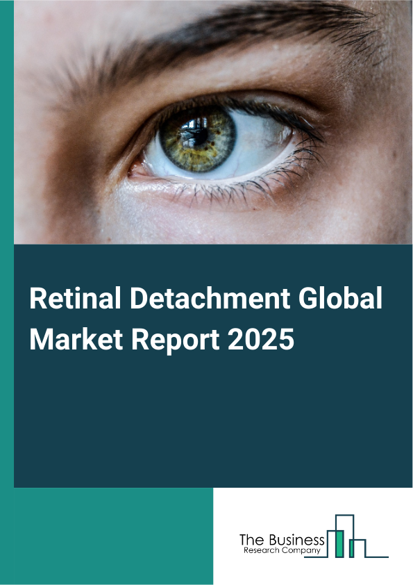 Global Retinal Detachment Market Report 2025