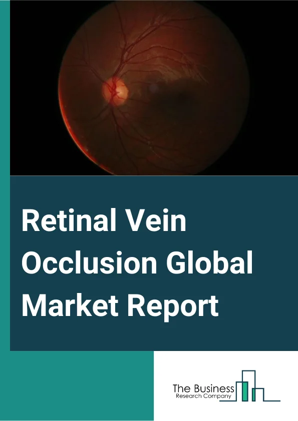Retinal Vein Occlusion Global Market Report 2024 