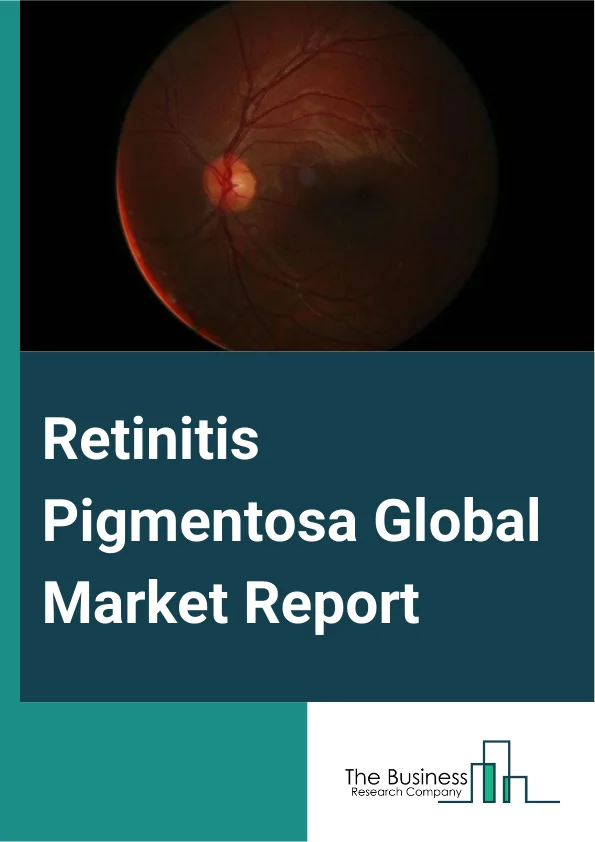 Global Retinitis Pigmentosa Market Report 2025